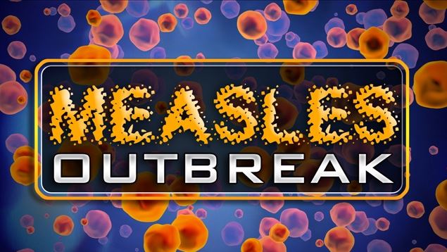 Measles_49740