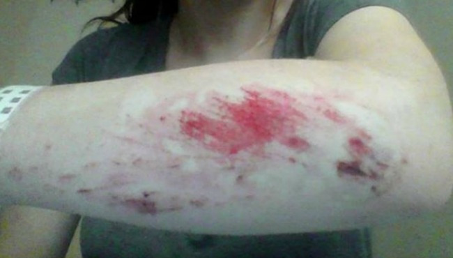 attempted-abduction-victim-abrasion_195267