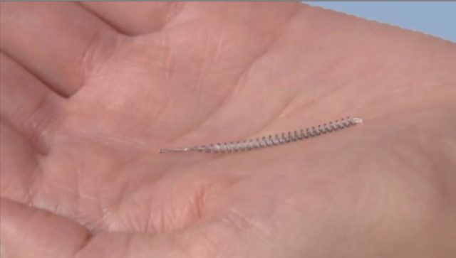 A person holds the medical implant device known as “Essure” in their hands._192189